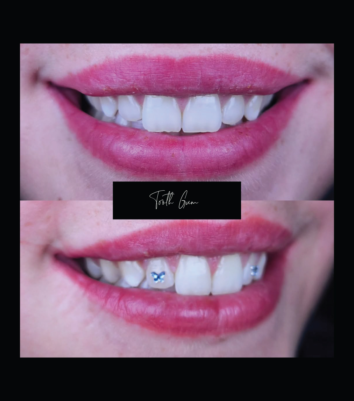 Tooth & Gum Treatment